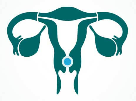 About cervical cancer