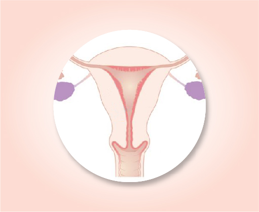 About uterine cancer